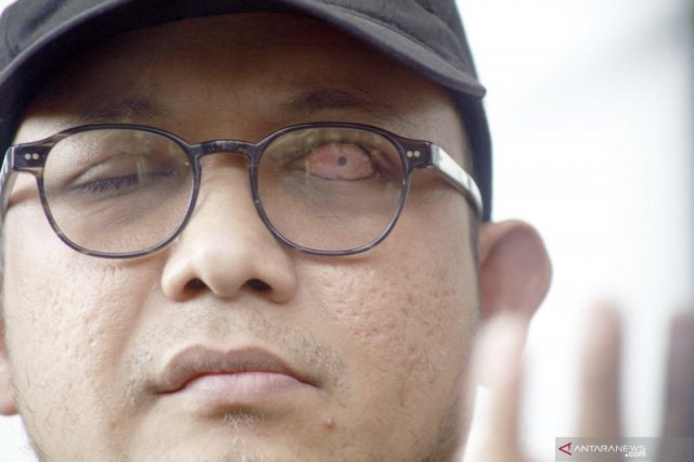 Penyidik KPK Novel Baswedan Terkonfirmasi Positif COVID-19