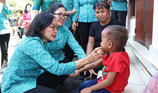 Cek Gigi Balita Langsung, Ny. drg. Ida Mahendra Jaya Ingatkan Orangtua Hindari Konsumsi Makanan Berlebihan Mengandung Gula